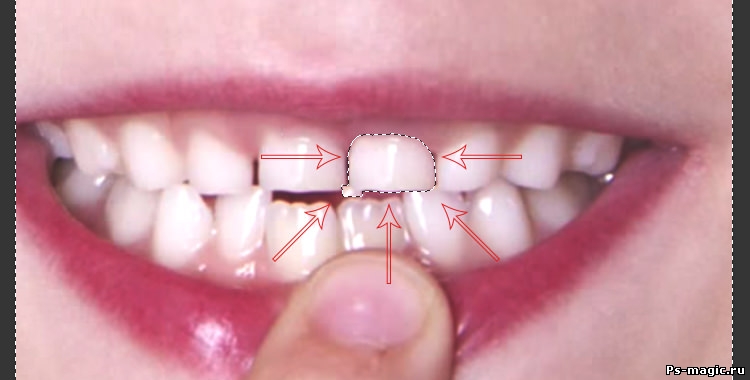 Шаг 5 Как вставить зуб в фотошопе