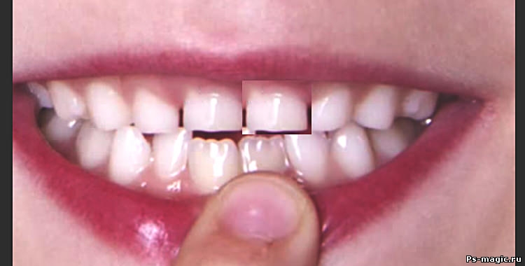 Шаг 2: Как вставить зуб в фотошопе