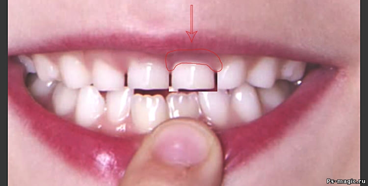 Шаг 3: Как вставить зуб в фотошопе